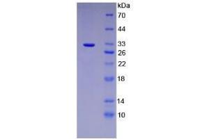 SDS-PAGE analysis of Mouse PTGES2 Protein. (PTGES2 蛋白)