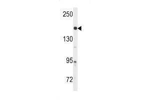 Western blot analysis of anti-ABL Antibody (Y251) in A2058 cell line lysates (35ug/lane) (ABL1 抗体)