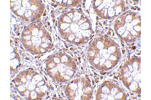 Immunohistochemistry (IHC) image for anti-Bone Marrow Stromal Cell Antigen 2 (BST2) (N-Term) antibody (ABIN1031283) (BST2 抗体  (N-Term))