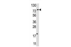 Western Blotting (WB) image for anti-Ubiquitin Specific Peptidase 16 (USP16) antibody (ABIN3001477) (USP16 抗体)