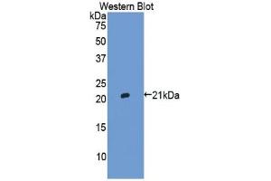 Western Blotting (WB) image for Haptoglobin (HP) ELISA Kit (ABIN6574217)