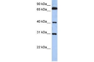 Human HeLa; WB Suggested Anti-DHRSX Antibody Titration: 0. (DHRSX 抗体  (C-Term))