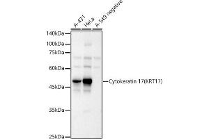 Western blot analysis of extracts of various cell lines, using Cytokeratin 17 (KRT17) antibody (ABIN6130112, ABIN6143023, ABIN6143024 and ABIN6213626) at 1:1298 dilution. (KRT17 抗体  (AA 133-432))