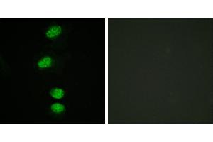 P-peptide - +Immunofluorescence analysis of HeLa cells, using Androgen Receptor (Phospho-Ser94) antibody. (Androgen Receptor 抗体  (pSer94))