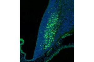 (ABIN6244147 and ABIN6577773) staining SKOR2 in mouse cerebellum at embryonic stage 12. (SKOR2 抗体  (C-Term))