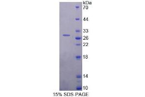 SDS-PAGE analysis of Human ETF1 Protein. (ETF1 蛋白)