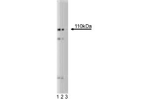 Western blot analysis of PI4-Kinase beta on a HeLa lysate. (pi 4-Kinase, beta (AA 411-626) 抗体)