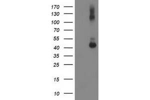 HEK293T cells were transfected with the pCMV6-ENTRY control (Left lane) or pCMV6-ENTRY GDAP1L1 (Right lane) cDNA for 48 hrs and lysed. (GDAP1L1 抗体)