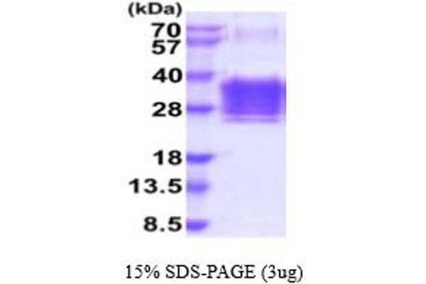 Orosomucoid 2 Protein (ORM2) (AA 19-201) (His tag)