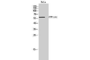 Western Blotting (WB) image for anti-Cytochrome P450, Family 11, Subfamily A, Polypeptide 1 (CYP11A1) (C-Term) antibody (ABIN3174630) (CYP11A1 抗体  (C-Term))