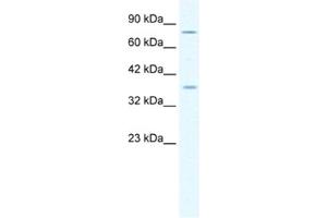 Western Blotting (WB) image for anti-Minichromosome Maintenance Deficient 4 (MCM4) antibody (ABIN2461392) (MCM4 抗体)