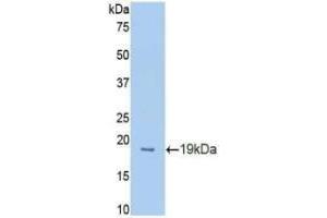 Western blot analysis of recombinant Mouse PROCR. (PROCR 抗体  (AA 32-167))