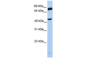 SMYD3 antibody used at 0. (SMYD3 抗体  (C-Term))