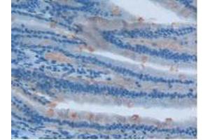 IHC-P analysis of Rat Intestine Tissue, with DAB staining. (Involucrin 抗体  (AA 461-551))