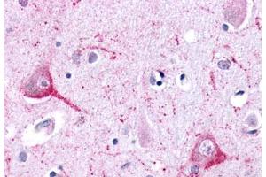 Anti-LPHN2 antibody  ABIN1049024 IHC staining of human brain, neurons and glia. (LPHN2 抗体  (N-Term))