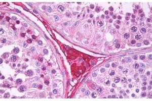 Anti-EDA2R antibody IHC staining of human testis, Leydig cells. (Ectodysplasin A2 Receptor 抗体)