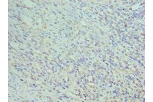 Immunohistochemistry of paraffin-embedded human epityphlon tissue using ABIN7155575 at dilution of 1:100 (CD74 抗体  (AA 137-296))