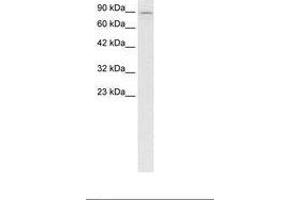 Image no. 2 for anti-Kinesin Family Member 5B (KIF5B) (AA 694-743) antibody (ABIN6736277) (KIF5B 抗体  (AA 694-743))