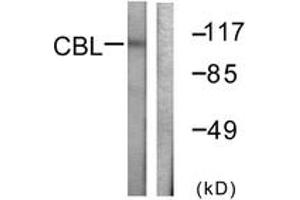Western Blotting (WB) image for anti-Cas-Br-M (Murine) Ecotropic Retroviral Transforming Sequence (CBL) (AA 740-789) antibody (ABIN2888650) (CBL 抗体  (AA 740-789))