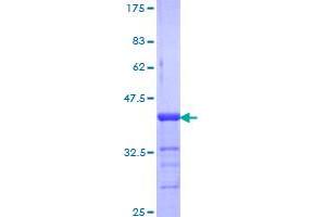 Image no. 1 for Nuclear Receptor Subfamily 3, Group C, Member 2 (NR3C2) (AA 1-110) protein (GST tag) (ABIN1312975) (NR3C2 Protein (AA 1-110) (GST tag))