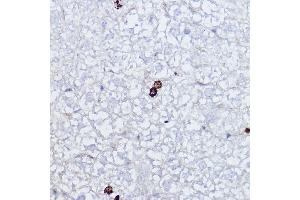 Immunohistochemistry of paraffin-embedded mouse liver using Phospho-Histone H3-S10 Rabbit pAb (ABIN7267687) at dilution of 1:2000 (40x lens). (Histone 3 抗体  (H3S10p))