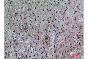 Immunohistochemistry (IHC) analysis of paraffin-embedded Human Brain, antibody was diluted at 1:100. (FCRL5 抗体  (Internal Region))