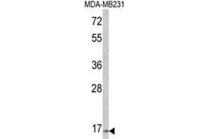 Western blot analysis of TSHB Antibody (Center) in MDA-MB231 cell line lysates (35ug/lane). (TSHB 抗体  (Middle Region))