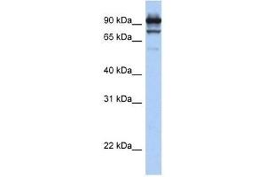 Western Blot showing STAT6 antibody used at a concentration of 1. (STAT6 抗体  (C-Term))