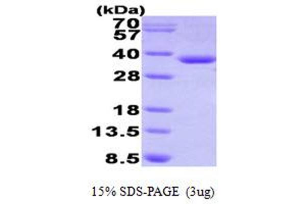 HADH Protein (AA 13-314) (His tag)