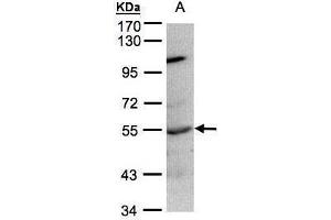 WB Image Sample(30 ug whole cell lysate) A:Raji , 7. (PTPN1 抗体)