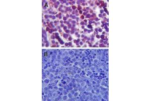 Immunohistochemistry (IHC) image for anti-Toll-Like Receptor 4 (TLR4) (Internal Region) antibody (ABIN6655892)