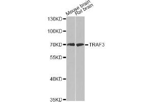 Western blot analysis of extracts of various cell lines, using TRAF3 antibody (ABIN5970321) at 1/500 dilution. (TRAF3 抗体)