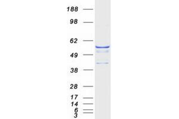 ATP6V1B1 Protein (Myc-DYKDDDDK Tag)