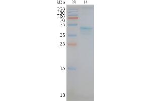 Human -Nanodisc, Flag Tag on SDS-PAGE (CCR5 蛋白)