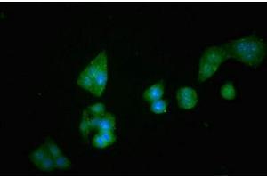 Immunofluorescent analysis of PC-3 cells using ABIN7149984 at dilution of 1:100 and Alexa Fluor 488-congugated AffiniPure Goat Anti-Rabbit IgG(H+L) (DPP4 抗体  (AA 473-588))