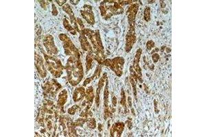 Immunohistochemical analysis of Alpha-tubulin (AcK40) staining in human breast cancer,mouse brain formalin fixed paraffin embedded tissue section. (alpha Tubulin 抗体  (acLys40))
