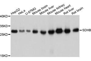 Western blot analysis of extracts of various cell lines, using SDHB antibody (ABIN5998756) at 1/1000 dilution. (SDHB 抗体)