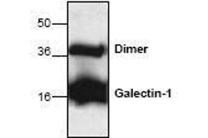 Image no. 1 for anti-Lectin, Galactoside-Binding, Soluble, 1 (LGALS1) antibody (ABIN127228) (LGALS1/Galectin 1 抗体)
