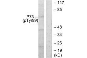 Western Blotting (WB) image for anti-Tumor Protein P73 (TP73) (pTyr99) antibody (ABIN2888508) (Tumor Protein p73 抗体  (pTyr99))