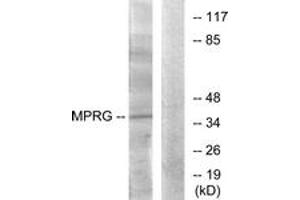 Western blot analysis of extracts from HuvEc cells, using MPRG Antibody. (PAQR5 抗体  (AA 281-330))