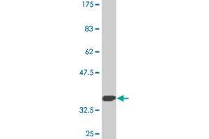 Western Blot detection against Immunogen (35. (Glutaminase 抗体  (AA 580-669))