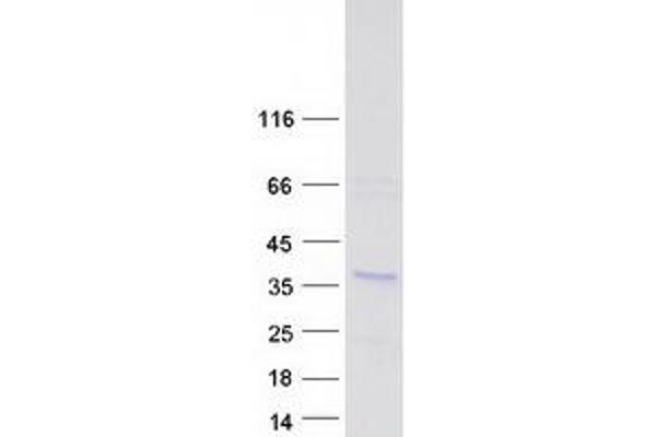 CHORDC1 Protein (Transcript Variant 2) (Myc-DYKDDDDK Tag)