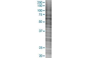 IKZF1 transfected lysate. (IKZF1 293T Cell Transient Overexpression Lysate(Denatured))