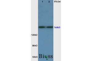 SDS-PAGE (SDS) image for anti-Fms-Related tyrosine Kinase 1 (VEGFR1) (FLT1) (AA 1162-1260) antibody (ABIN725795)