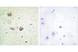 Peptide - + (5HT1B Receptor 抗体  (Internal Region))