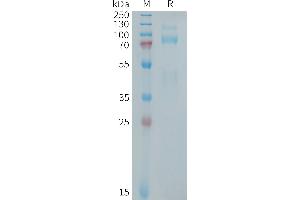 Human MET Protein, His Tag on SDS-PAGE under reducing condition. (c-MET Protein (AA 25-932) (His tag))