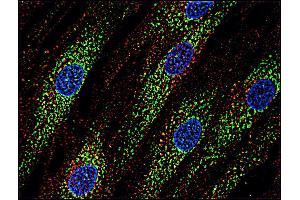 Immunofluorescence (IF) image for anti-CD63 (CD63) antibody (ABIN94214)