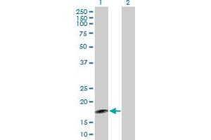 Western Blot analysis of AGXT2L2 expression in transfected 293T cell line by AGXT2L2 MaxPab polyclonal antibody. (AGXT2L2 抗体  (AA 1-175))