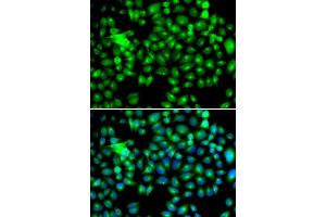 Immunofluorescence (IF) image for anti-Heat Shock 22kDa Protein 8 (HSPB8) (AA 1-196) antibody (ABIN6219596) (HSPB8 抗体  (AA 1-196))