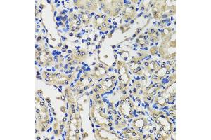 Immunohistochemistry of paraffin-embedded mouse kidney using SCG3 antibody. (SCG3 抗体)